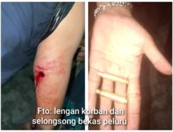 Warga Pekan Labuhan Jadi Korban Dugaan Salah Tembak