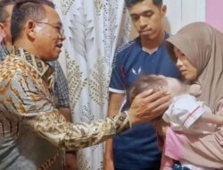 Pemko Medan Salurkan Bantuan ke Balita Sakit Kanker Mata